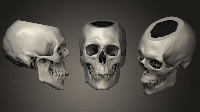 Анатомия скелеты и черепа (Череп Мужской 49лет, ANTM_1287) 3D модель для ЧПУ станка